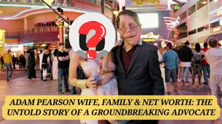 Exploring the Life and Relationship of Adam Pearson: The Story of Adam Pearson's Wife