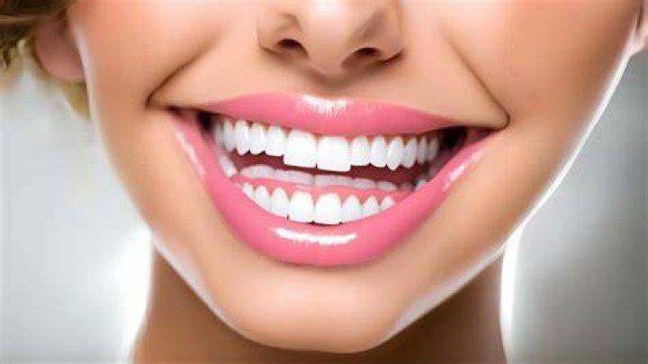 The Fascinating World of Dior Teeth: A Comprehensive Guide